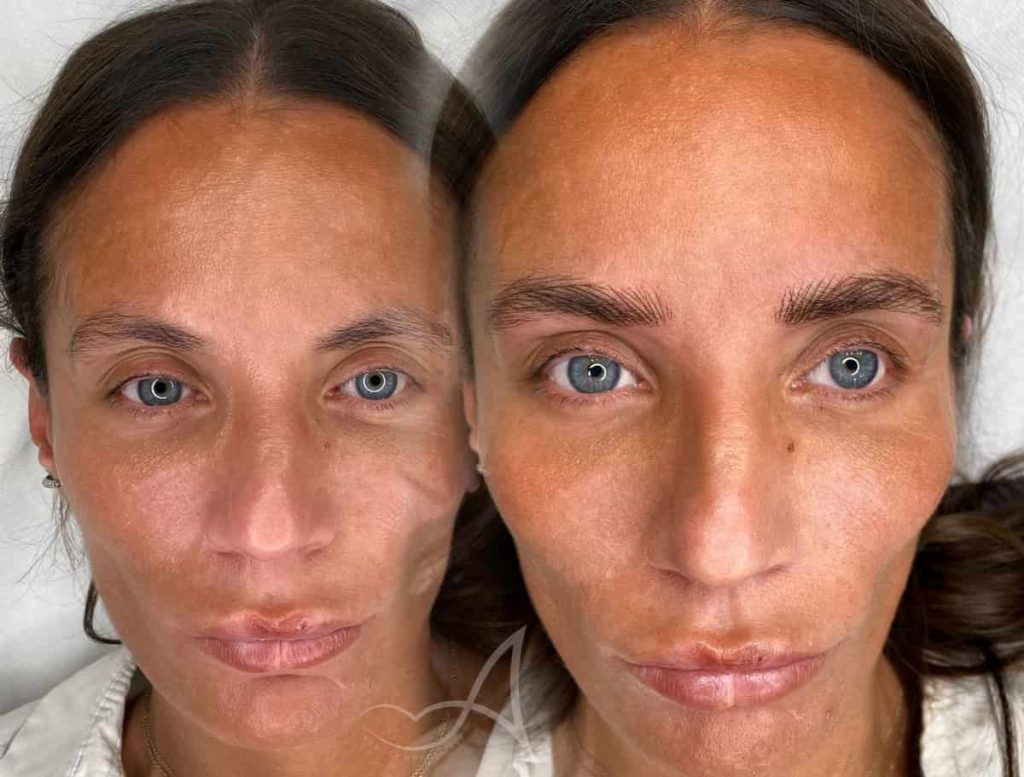 trucco permanente sopracciglia iper realistico prima e dopo